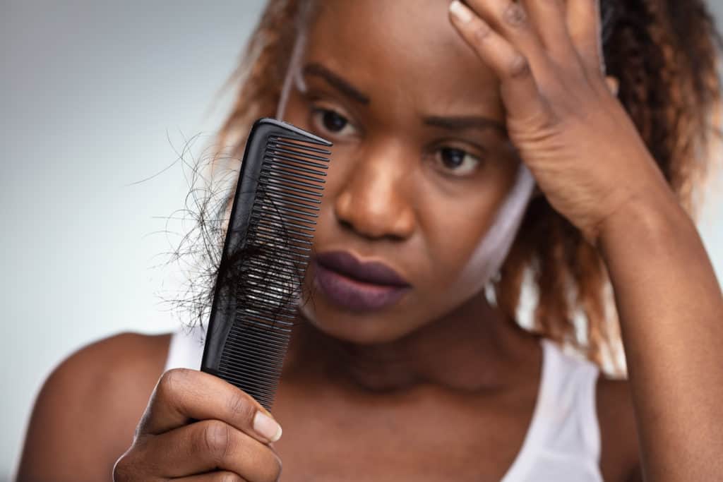 Alopecia Areata