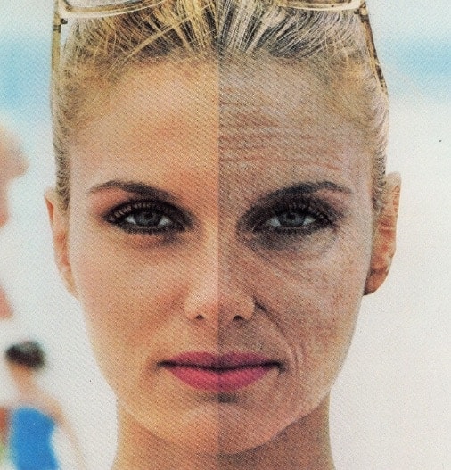 Medical Grade Chemical Peel