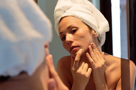 Facial Scars