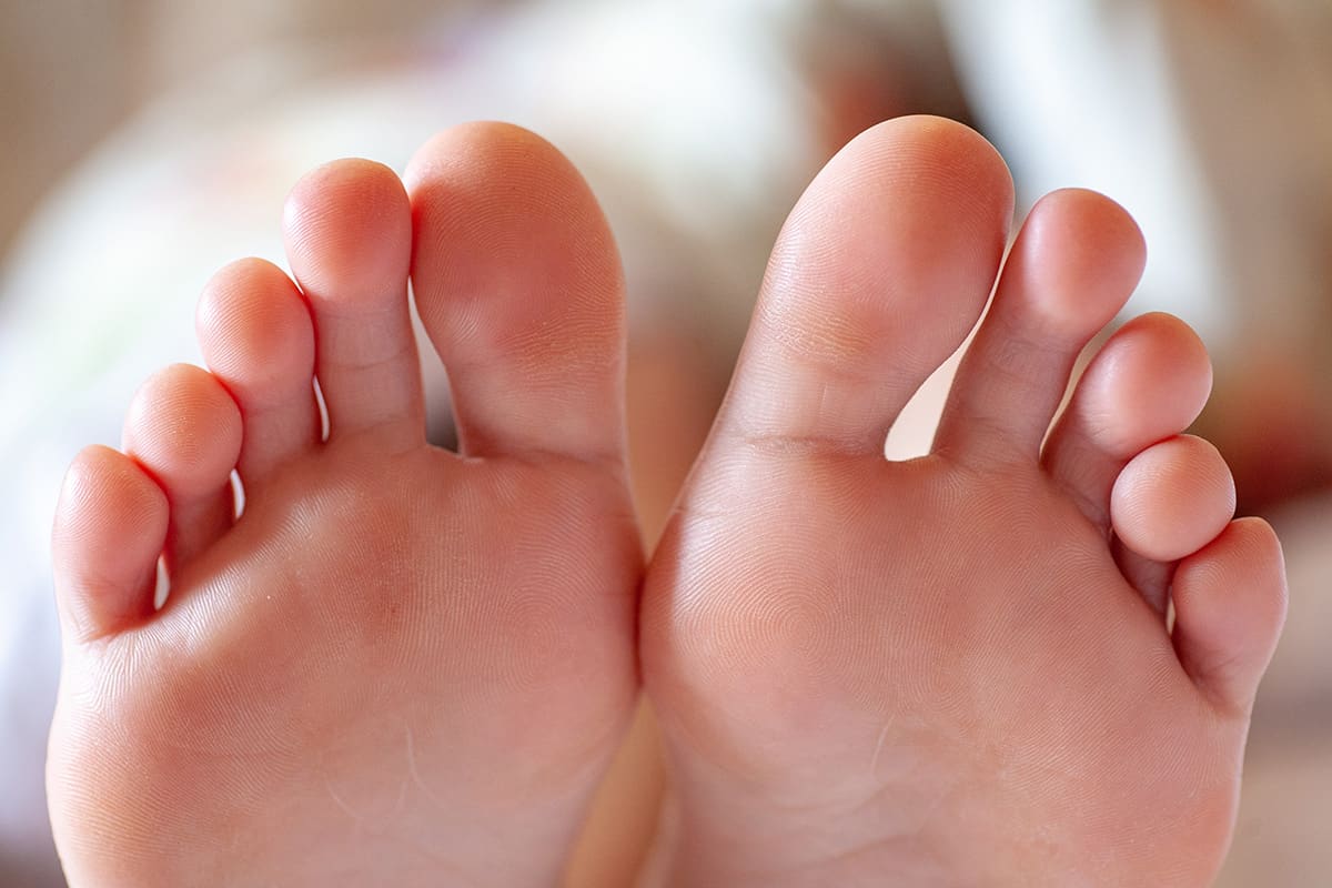Fungal Skin Infections