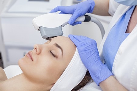 IPL Photo Facial