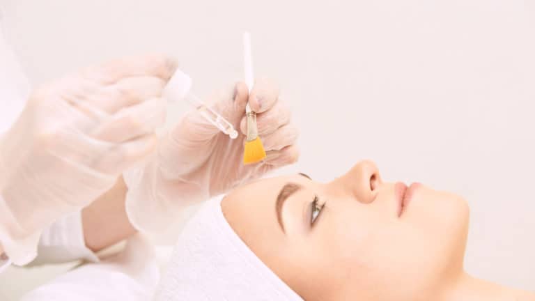 Light Chemical Peels