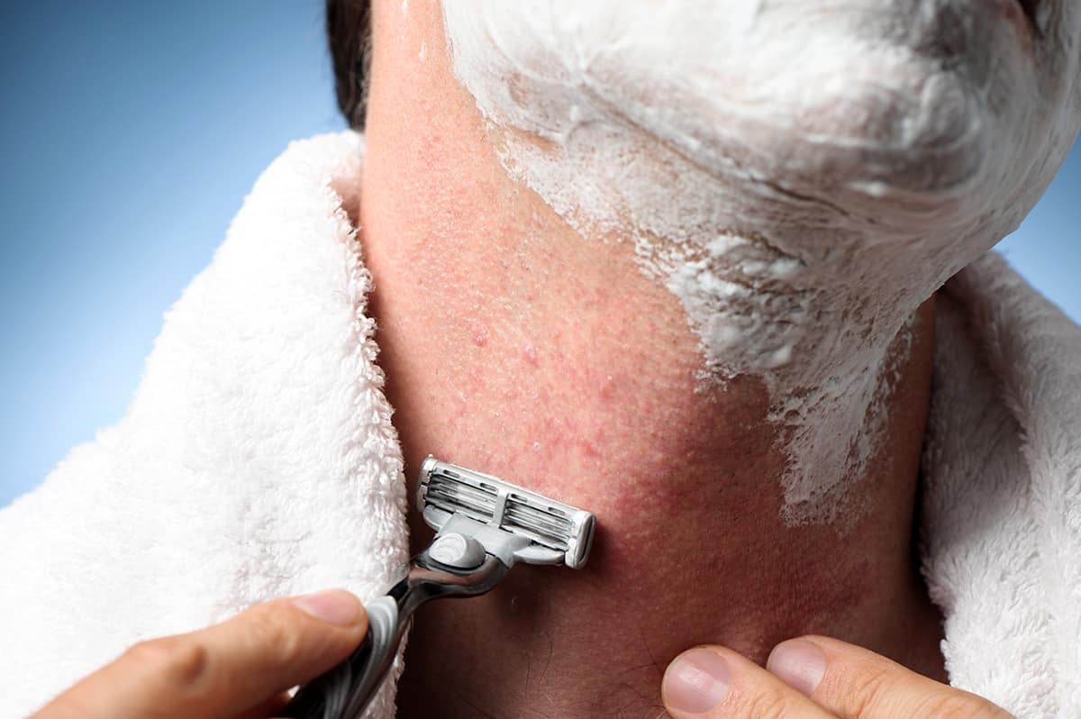 Razor Bumps