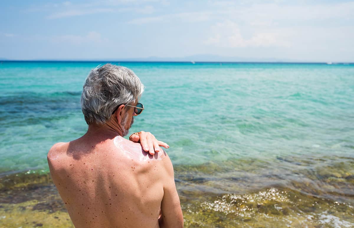 Actinic Keratosis